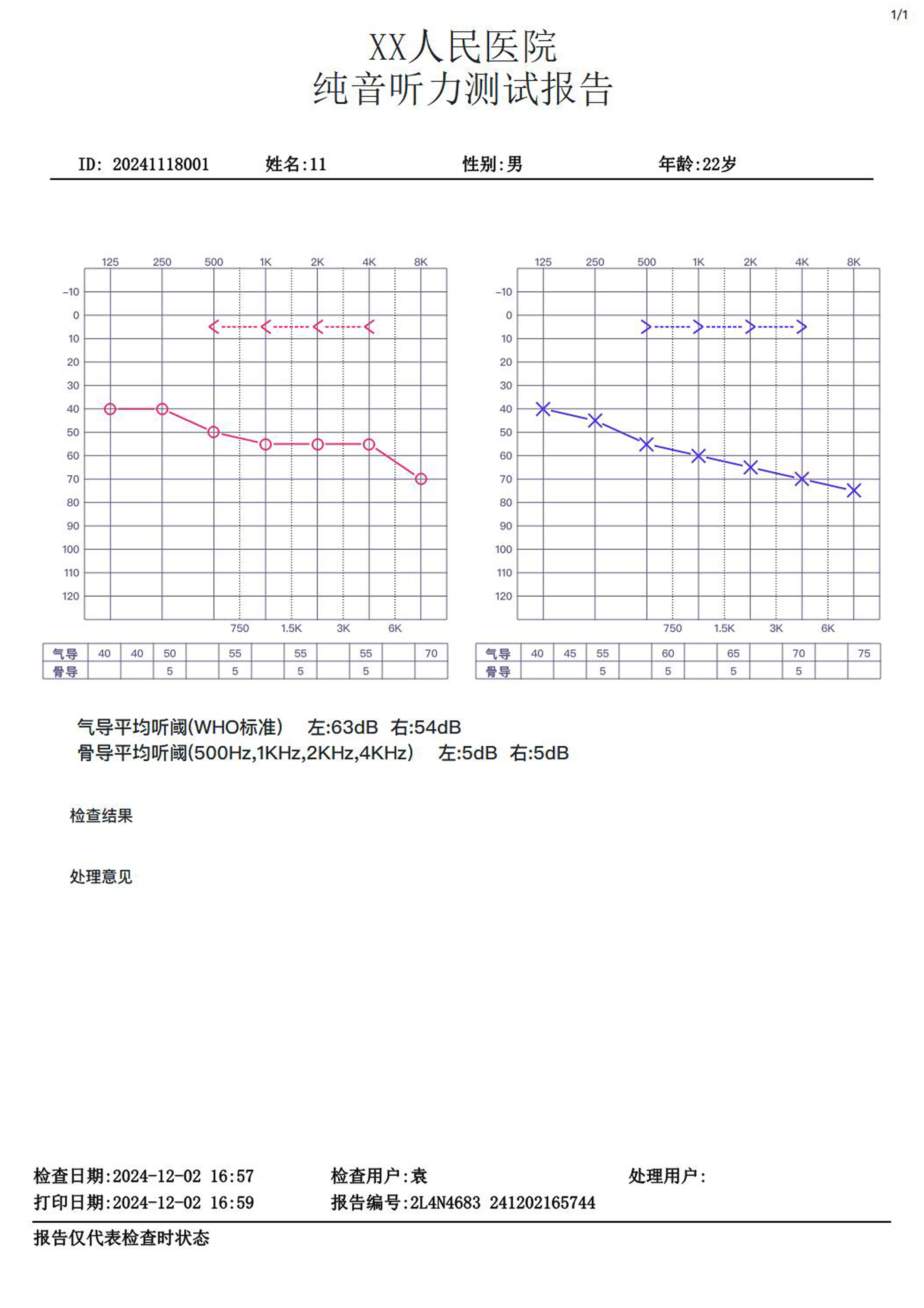 聆康纯音听力计LK-227升级版(图2) 聆康纯音听力计LK-227标准版B(图2)
