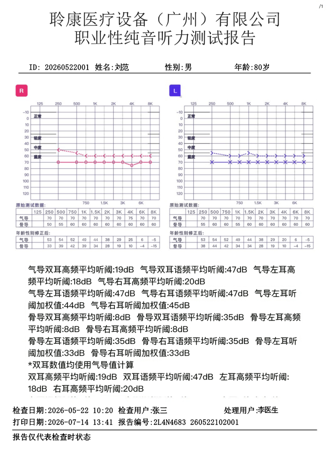 聆康纯音听力计|职业健康检查/职业病诊断核心优势(图3) 聆康纯音听力计|职业健康检查/职业病诊断核心优势(图3)